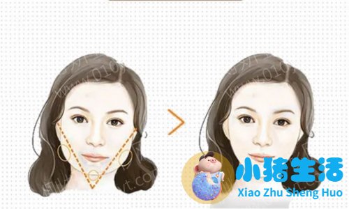 悦美网整形案例图片