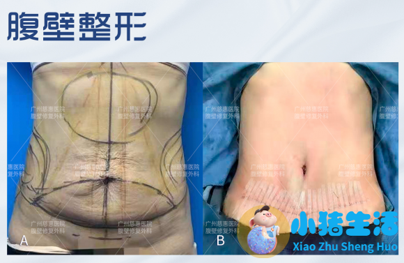 悦美网整形案例图片