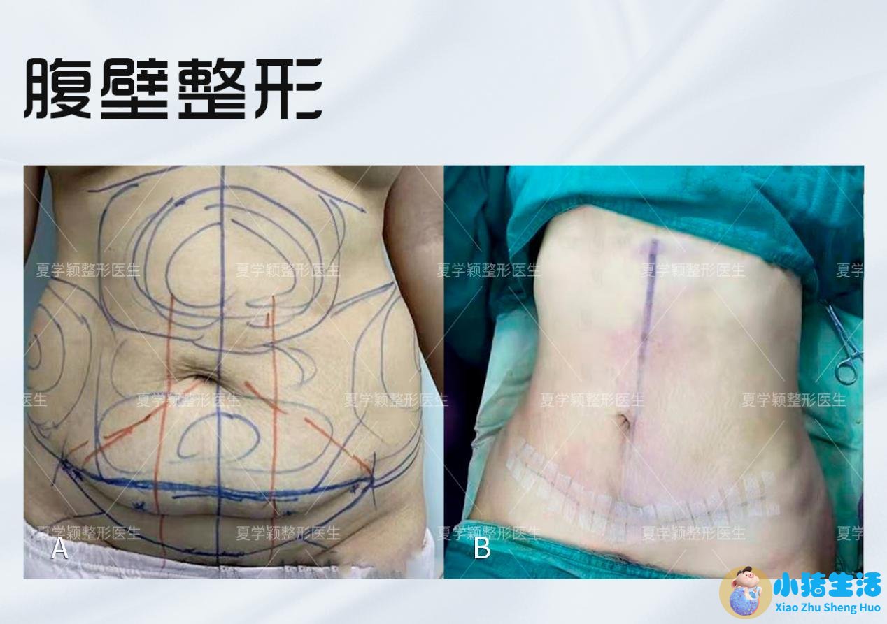 悦美网整形案例图片
