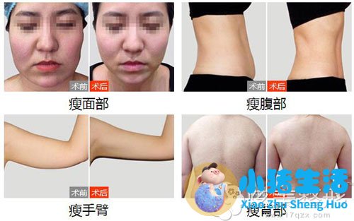 悦美网整形案例图片