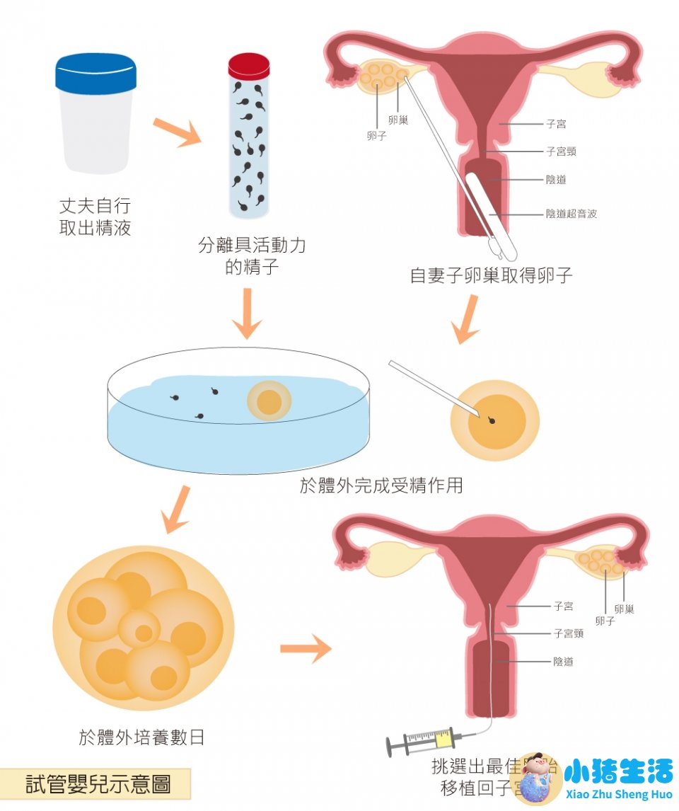 中国什么时候有试管婴儿技术