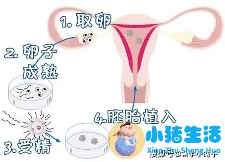 中国什么时候有试管婴儿技术