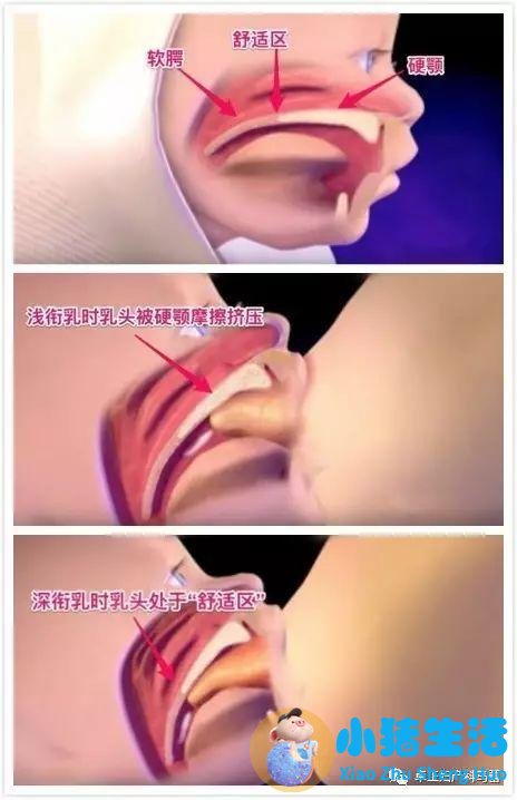 母乳不足的原因分析