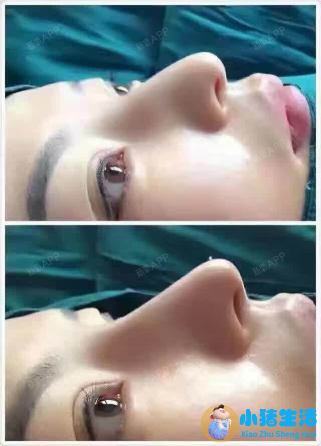 悦美网整形案例图片