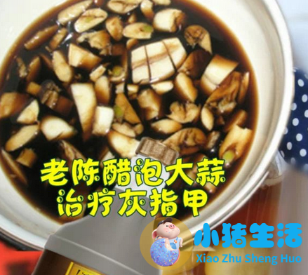 金钱草颗粒治肾结石效果好不好