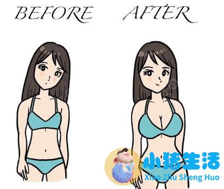 胸部整形案例