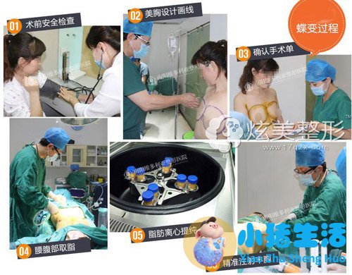 悦美网整形案例