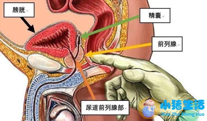 前列腺炎与性功能障碍:中青年男性保健必读