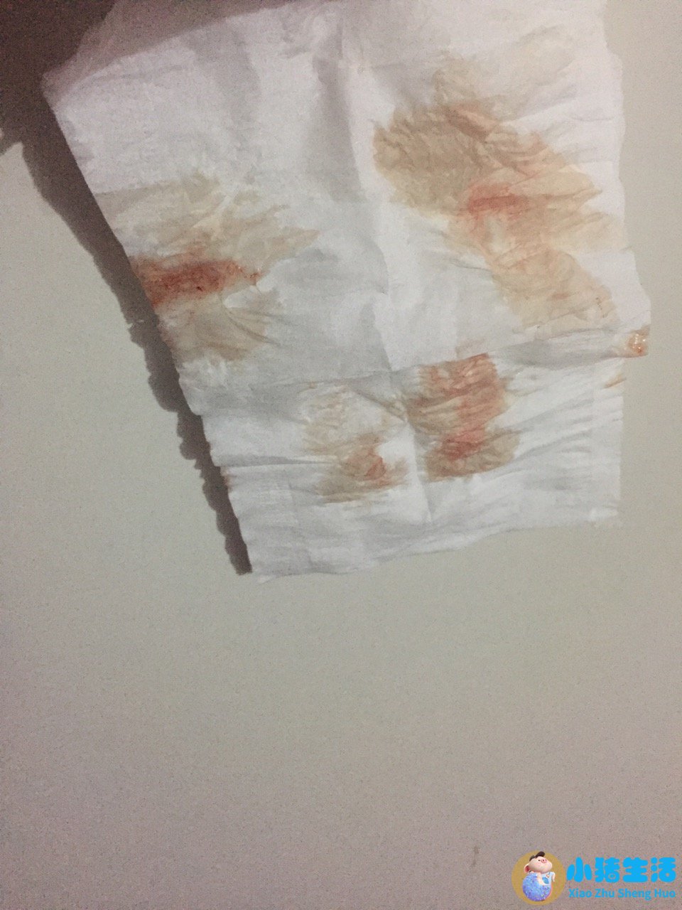 少量出血 怀孕