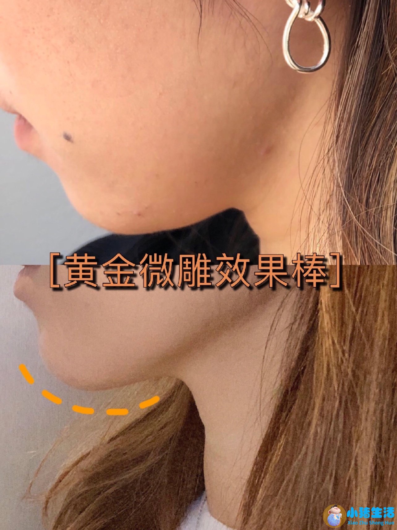 脸部整形案例