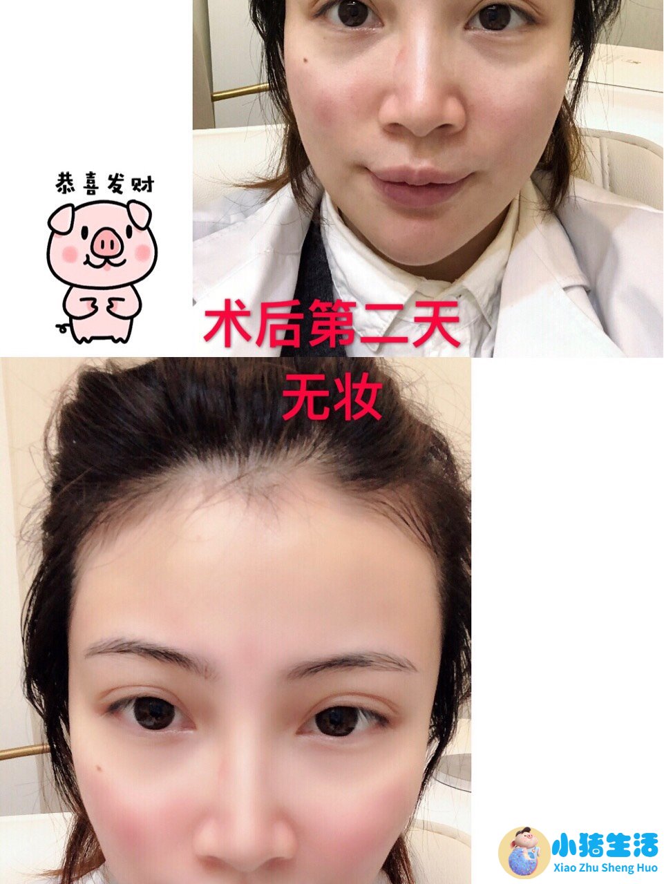 脸部整形案例