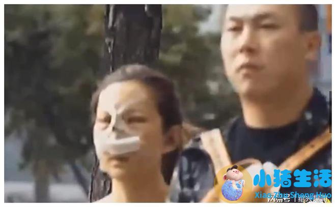 佳美整形失败案例