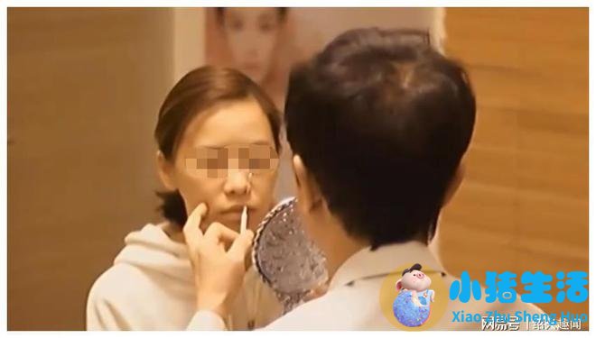 佳美整形失败案例