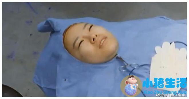 佳美整形失败案例