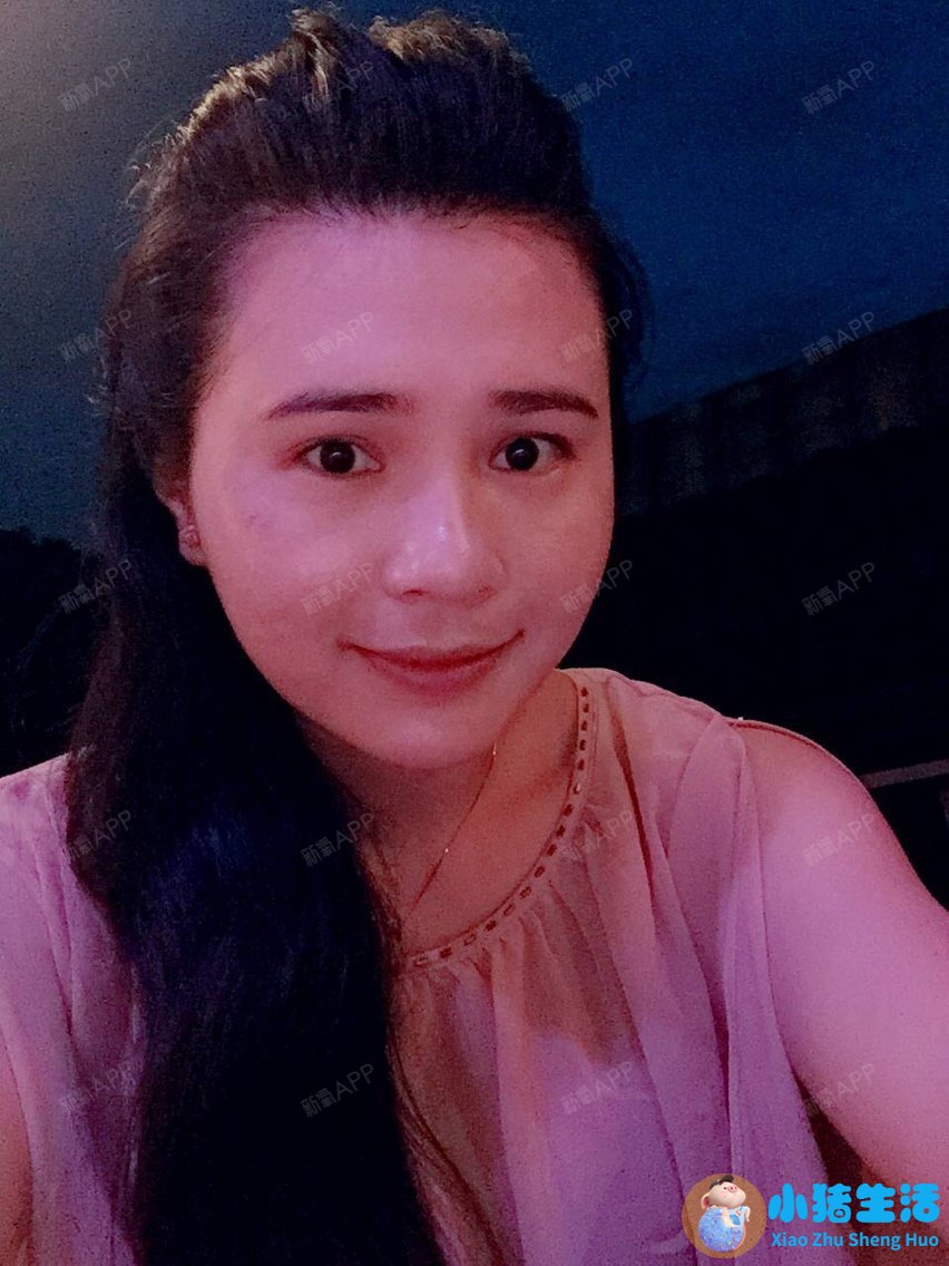 佳美整形失败案例
