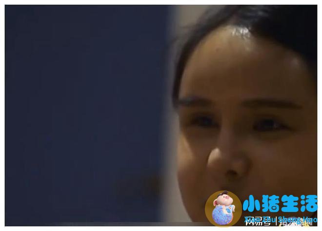佳美整形失败案例