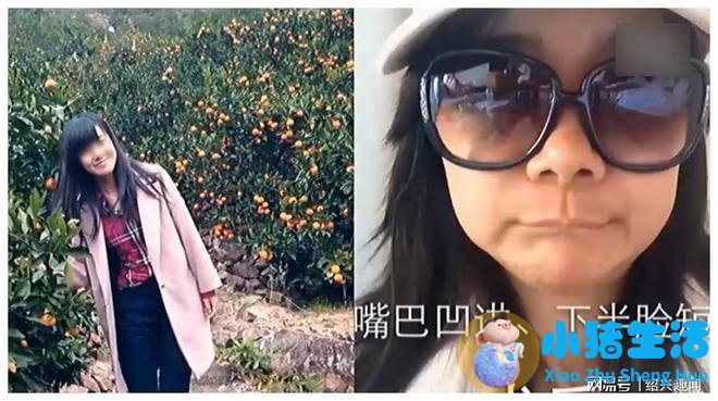 佳美整形失败案例