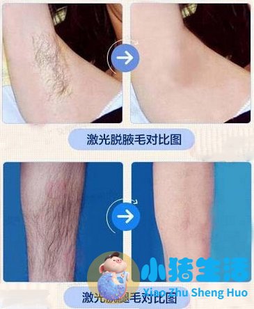 打玻尿酸效果能永久吗
