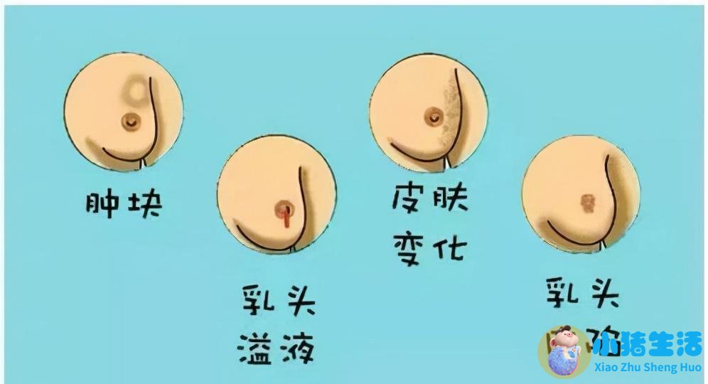 乳晕大是怎么回事