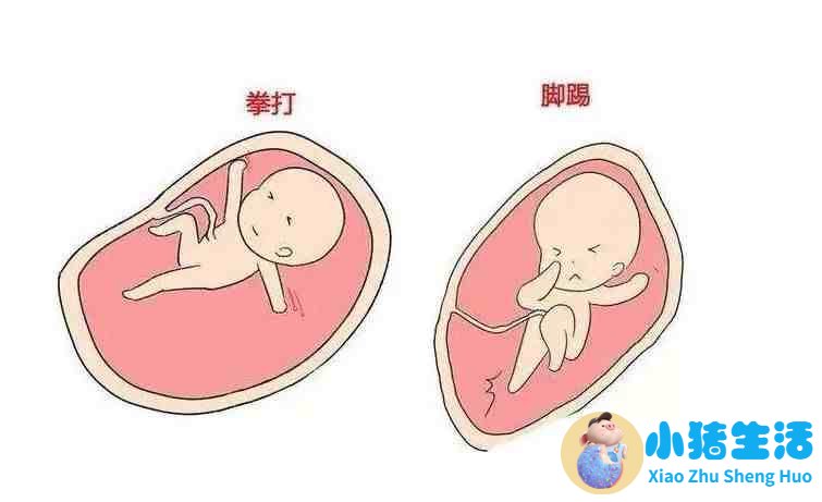 怀孕nt能不能看出来男女性别