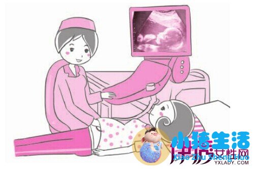 怀孕nt能不能看出来男女性别