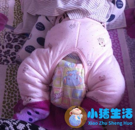 NT彩超上这几个数据，真的能看出是男宝