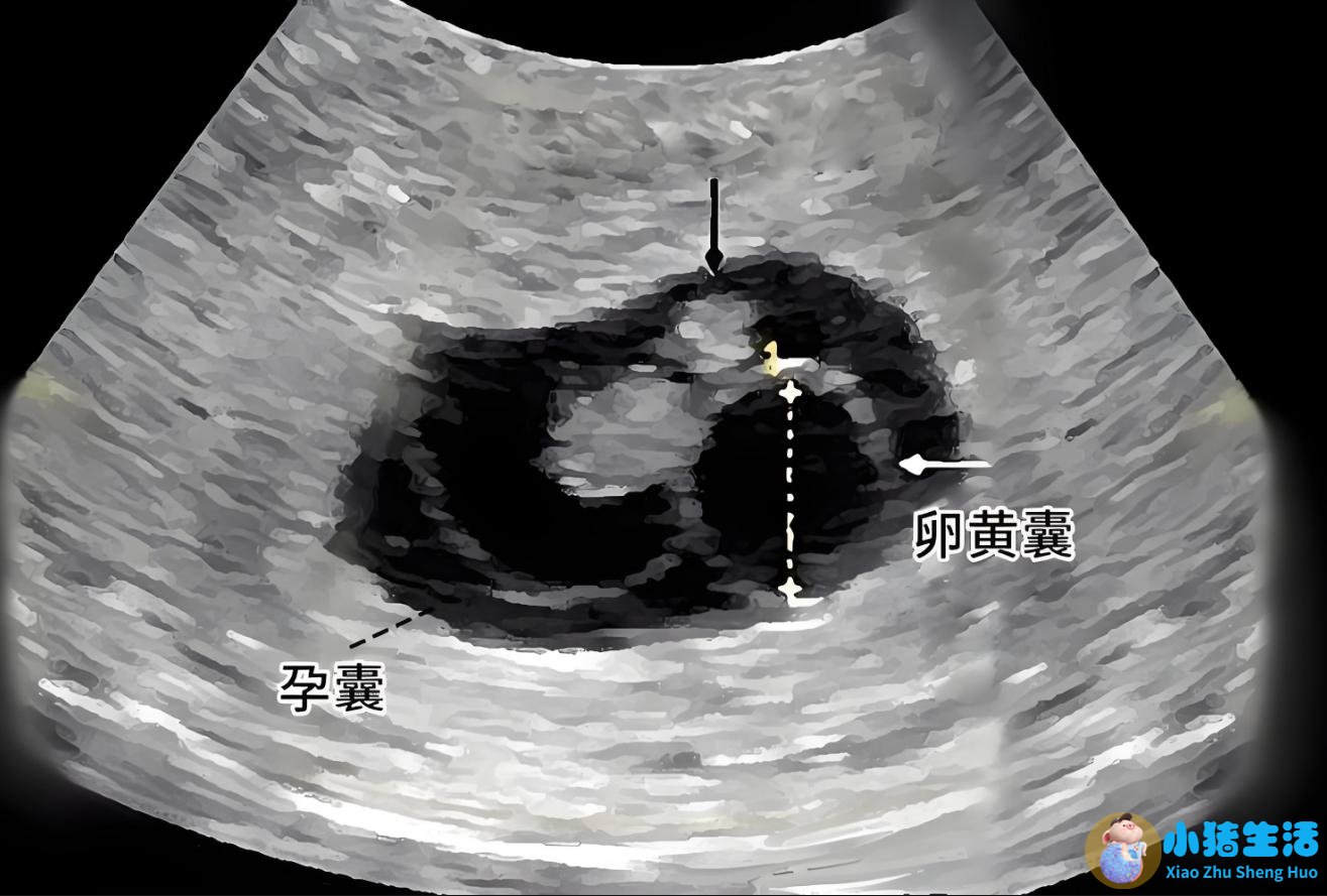 怀孕nt能不能看出来男女性别