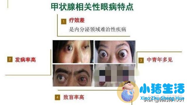 胸锁乳突肌有哪些症状