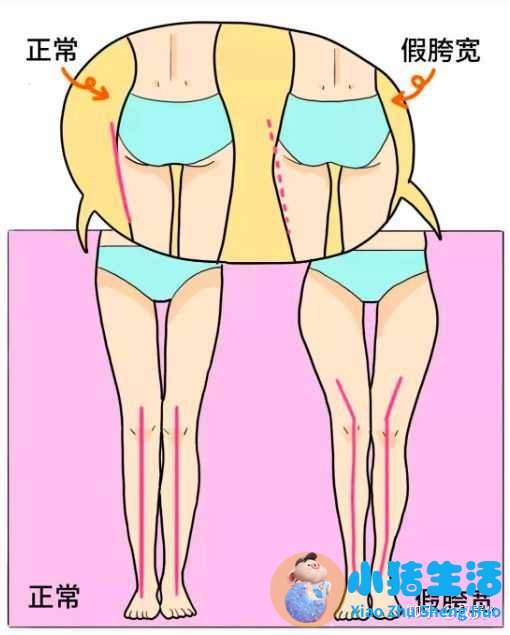 大腿局部减肥