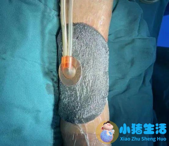最具影响力医学新闻
