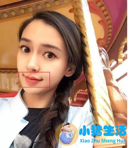 打嘟嘟唇适合什么牌子的玻尿酸？