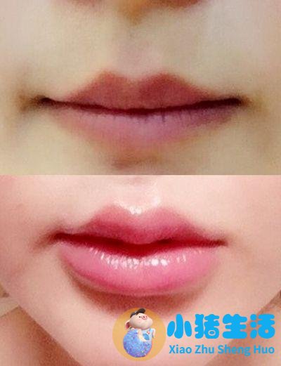 请问玻尿酸原液哪个牌子的最好