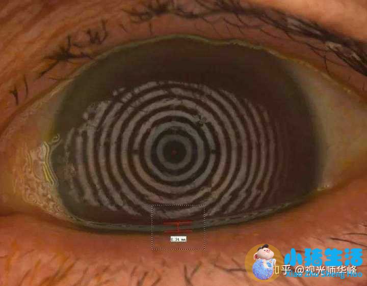 人工泪液哪个牌子好？