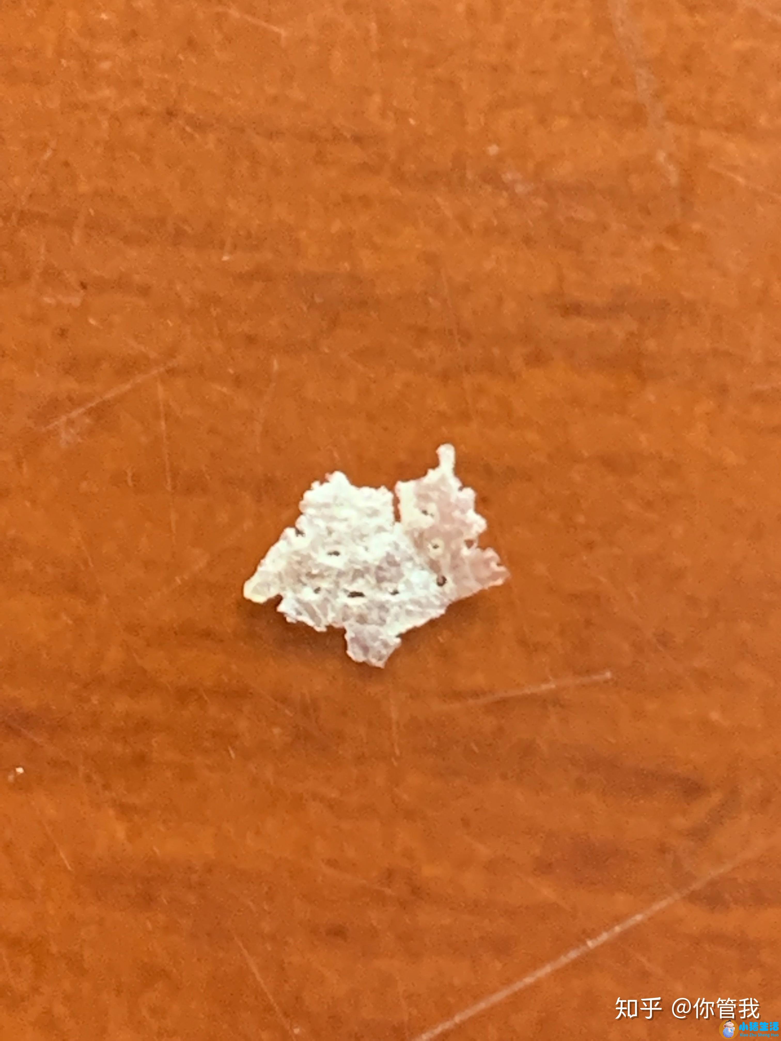 有严重的头皮屑怎么办