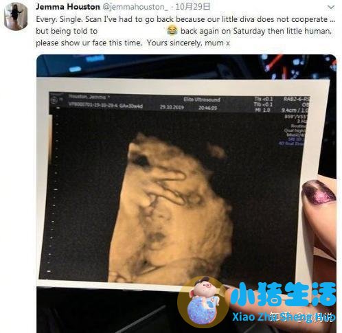 孕妇梦见别人指着自己说没有怀孕