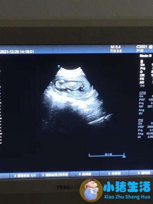 孕妇梦见别人指着自己说没有怀孕