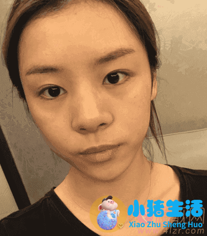 长沙协雅整形失败案例