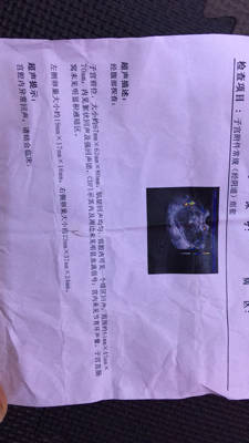 剖腹产二个月后又怀孕