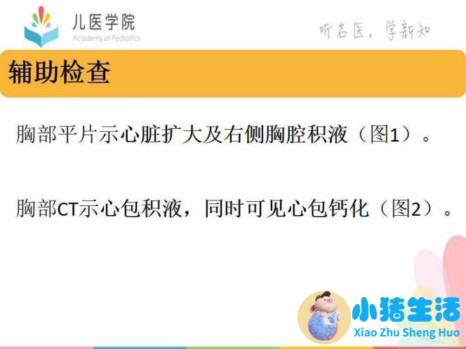 缩窄性心包炎 中医治疗