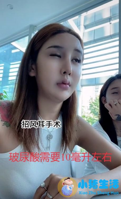 招风耳整形案例