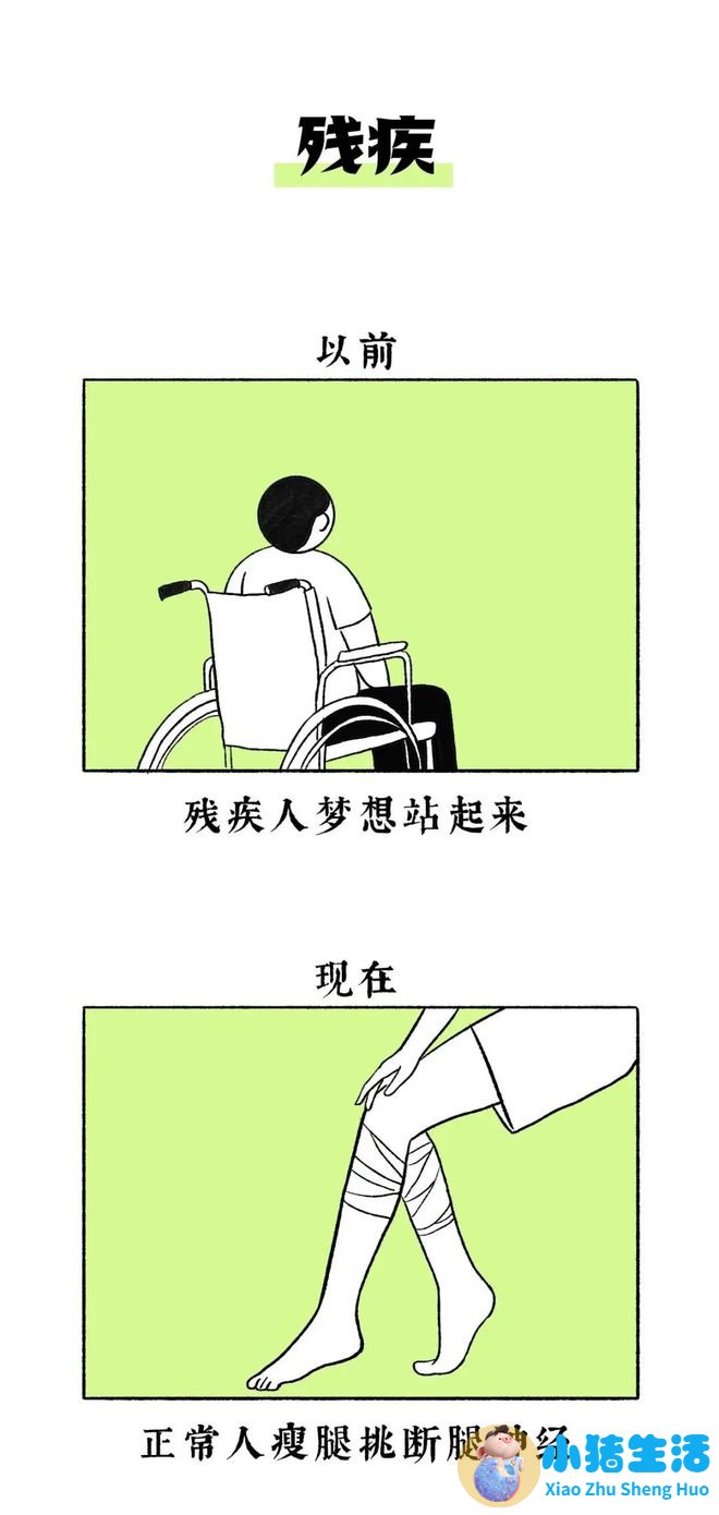 招风耳整形案例
