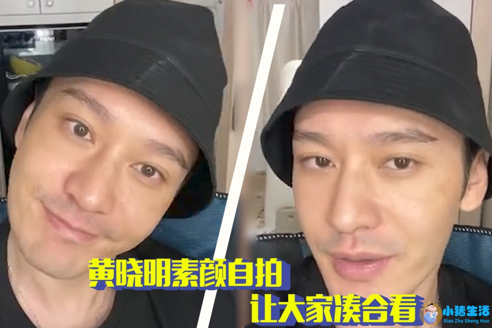 做电波拉皮除皱价