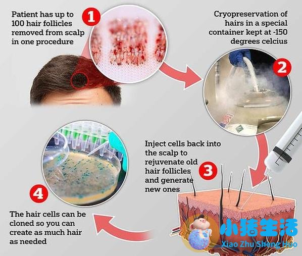 头发能不能克隆人