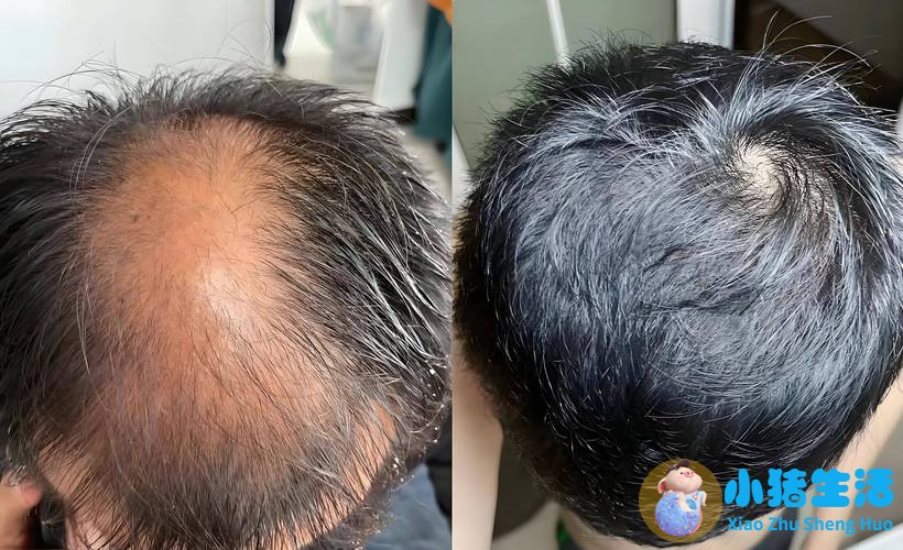 头发能不能克隆人