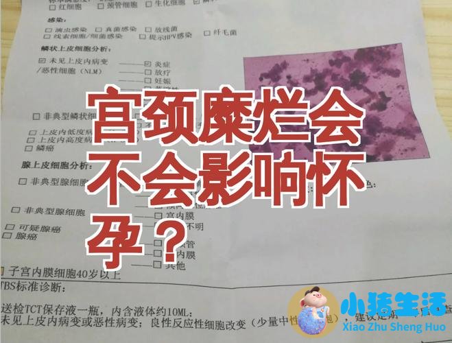 线索细胞阳性影响怀孕