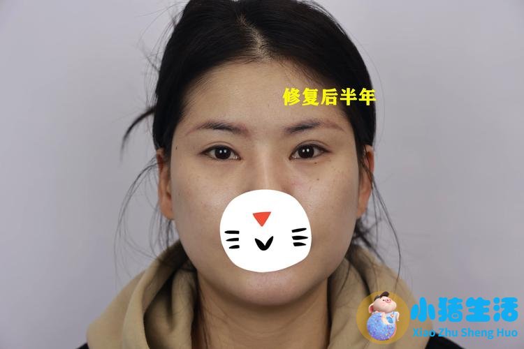 悦美网整形案例