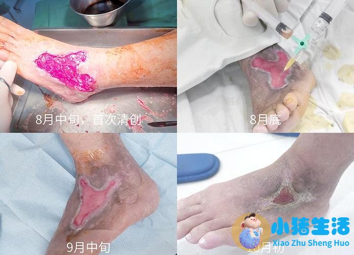 悦美网整形案例