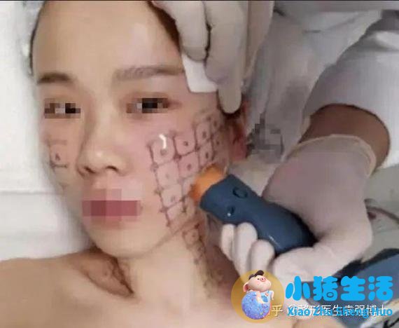 悦美网整形案例