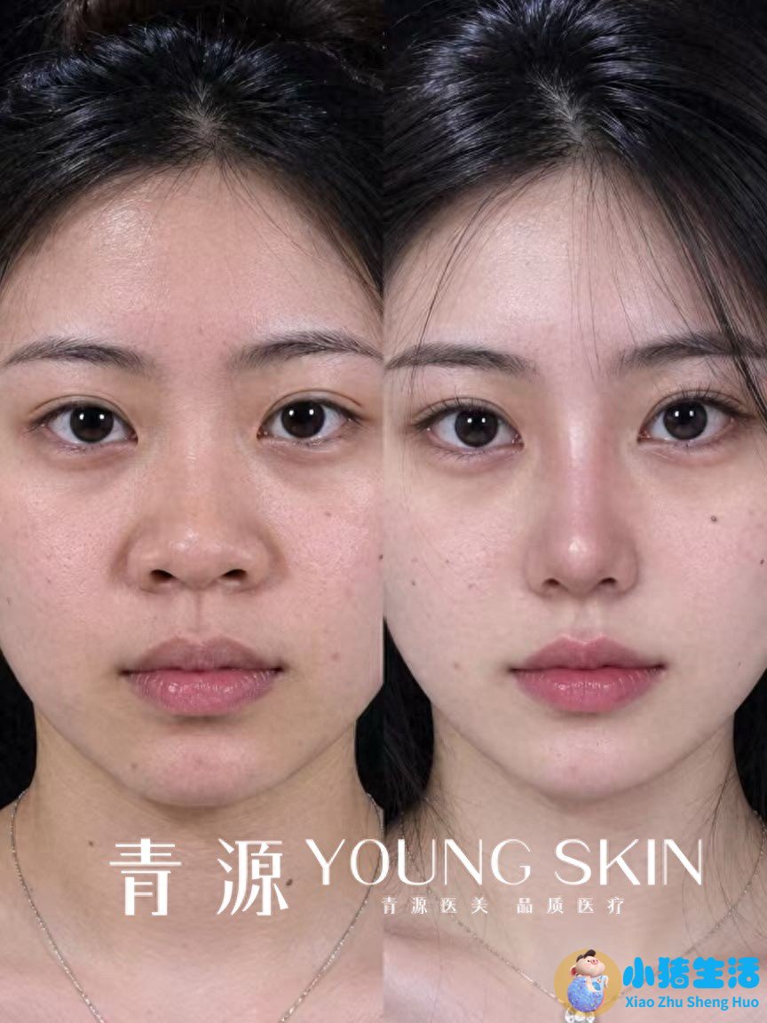 悦美网整形案例