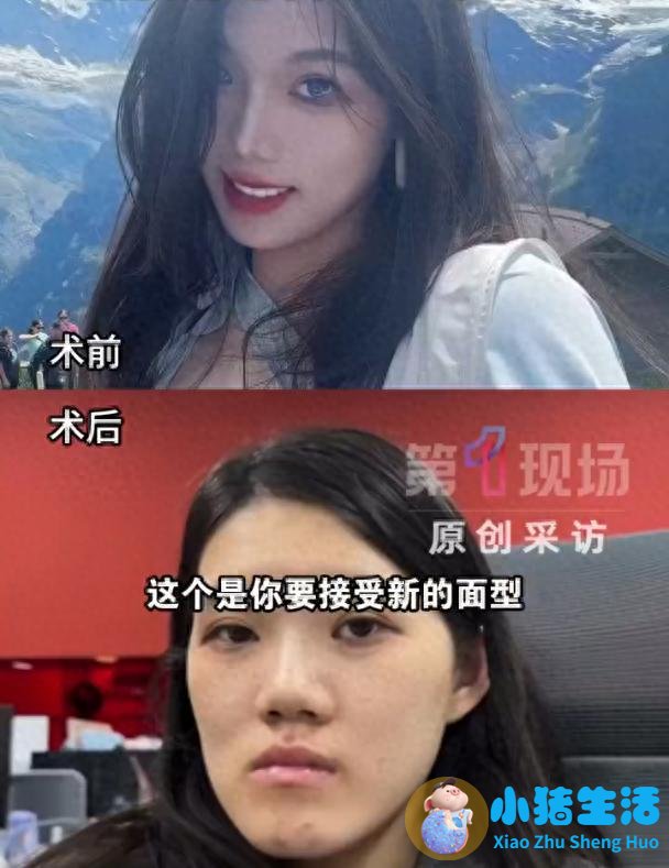 快评丨正颌手术反成“鞋拔子脸”，医生
